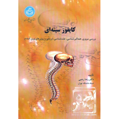 کتاب کایفوز سینه ای