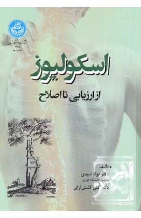  خرید کتاب اسکولیوز. فواد صیدی.  انتشارات:   دانشگاه تهران.