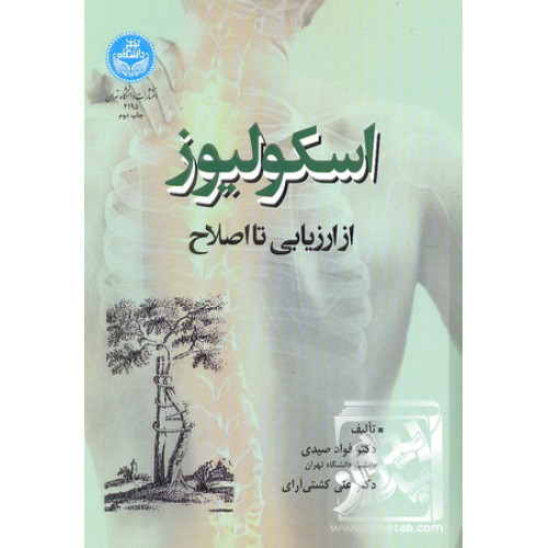 کتاب اسکولیوز